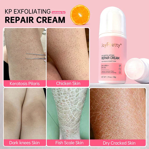 Body Cream Chicken Skin Removal Treatment Keratosis Pilaris Lotion Bumpy Rough Pore Spots Care Moisturizer Whitening Creams 60g